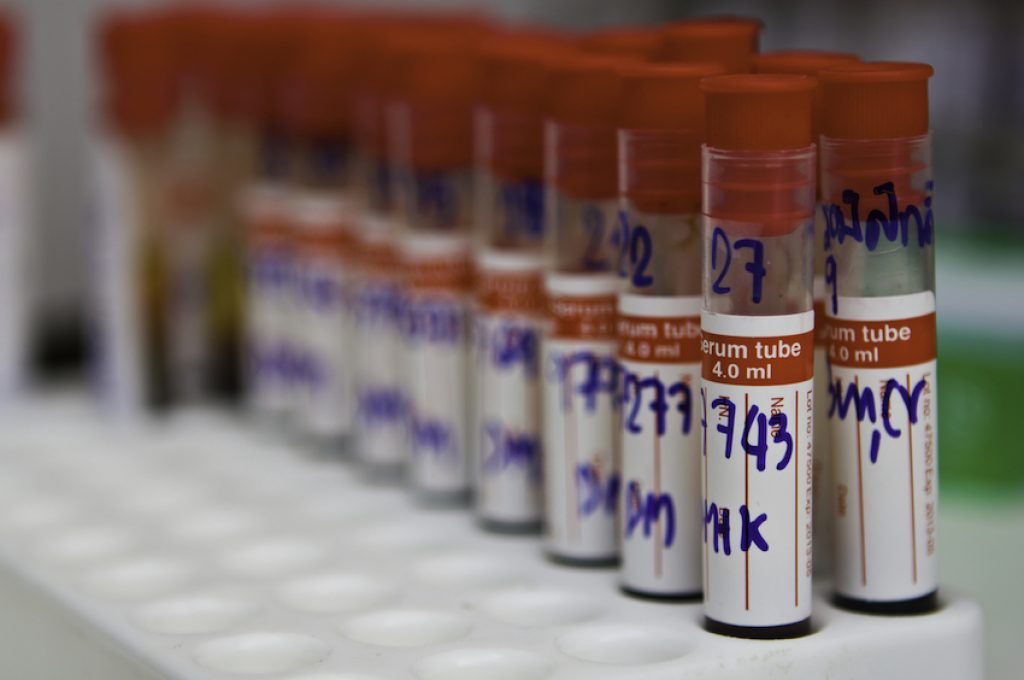 many test tubes with blood being tested