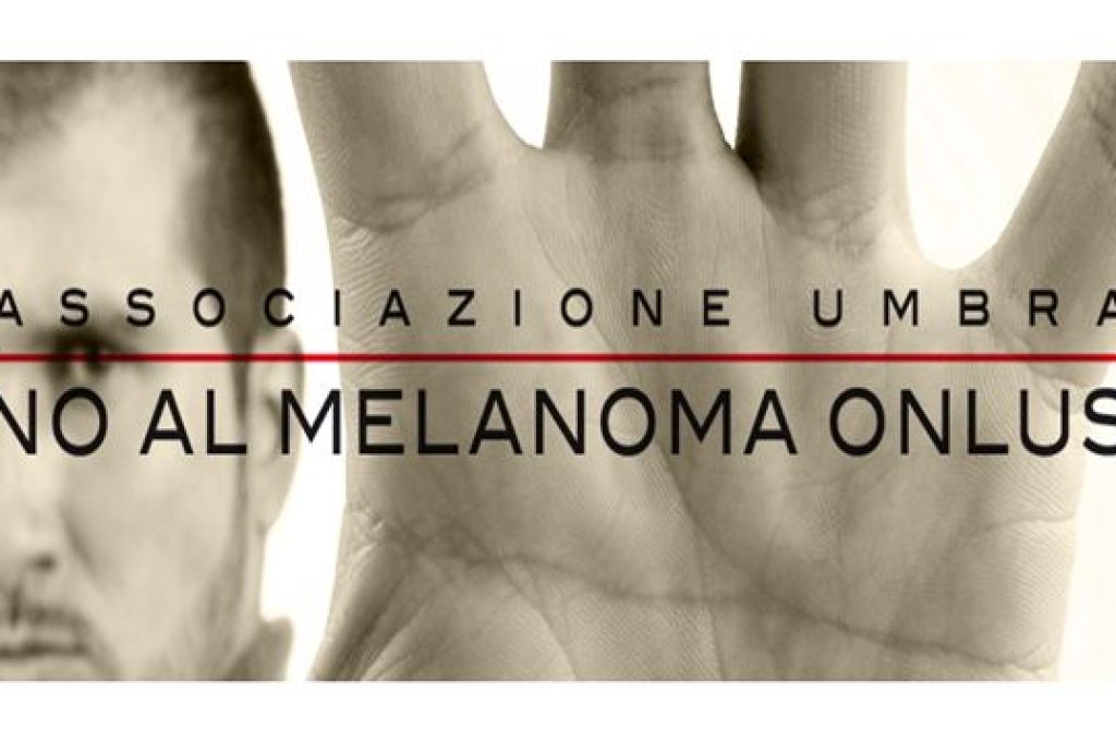 ass-melanoma