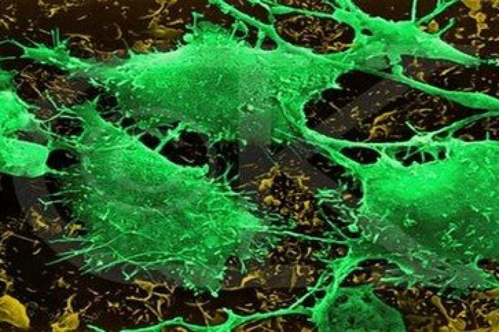 cellule-tumorali