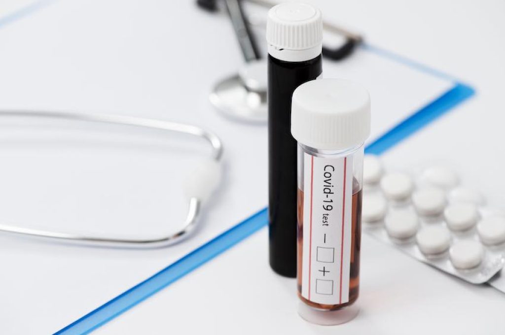 coronavirus provetta e pastiglie