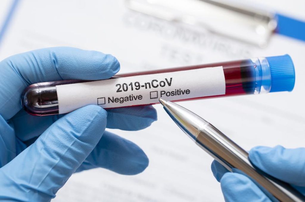 coronavirus provetta