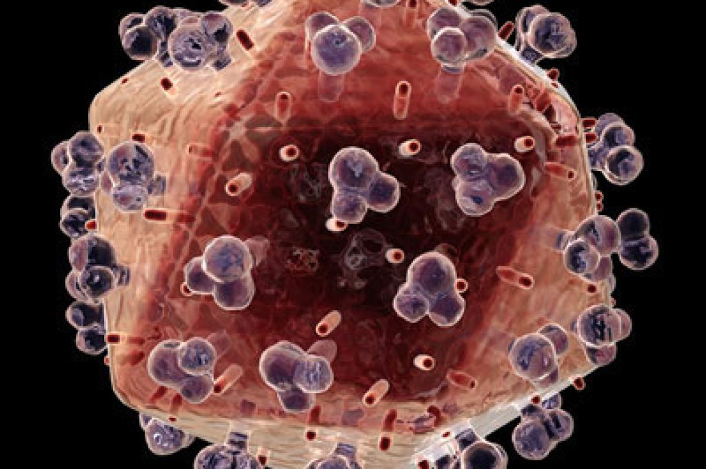 hiv-aids