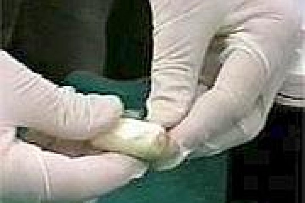 ovulococaina1